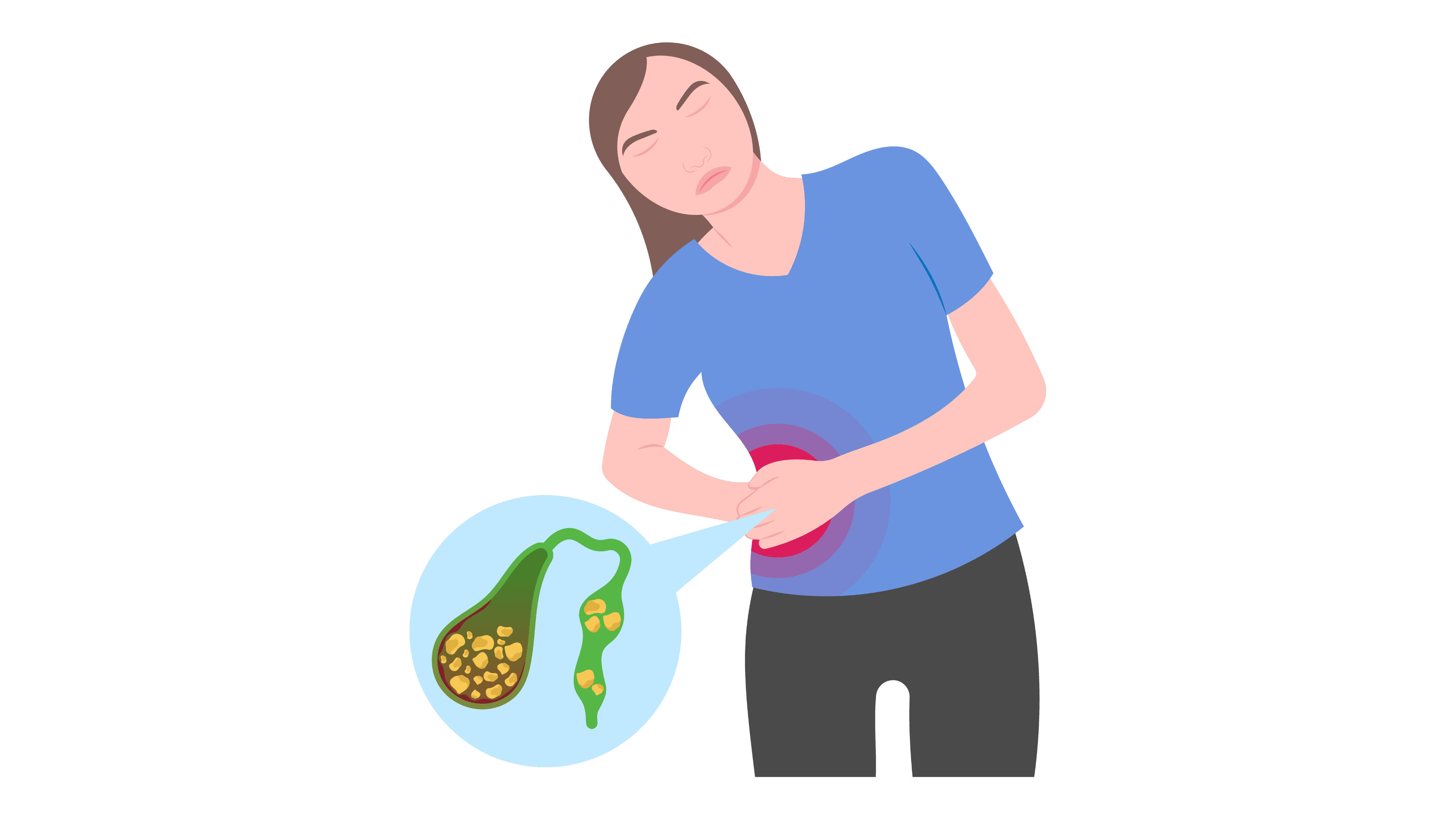 Minimally invasive GallStone surgery procedure in Nashik