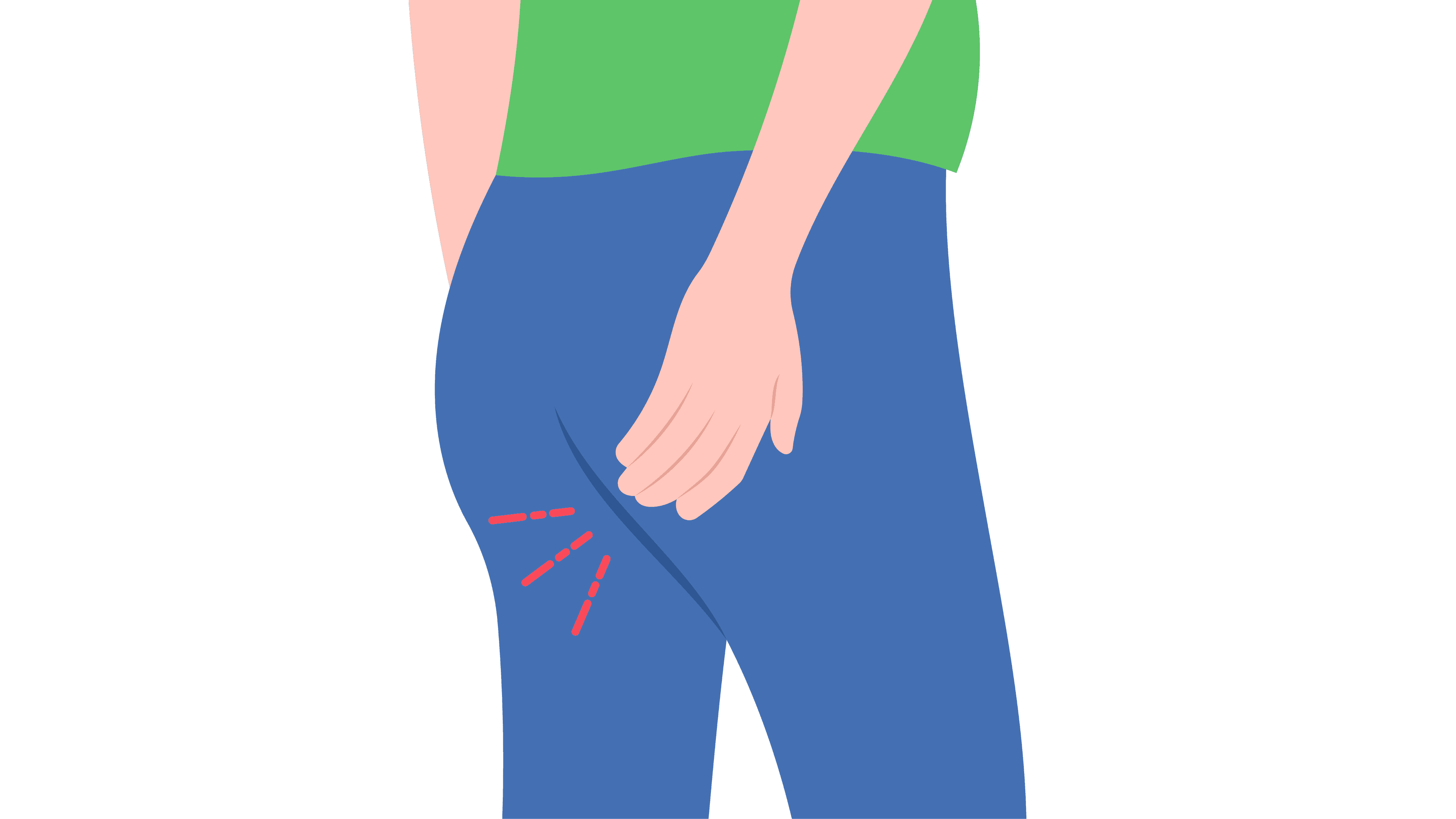 Minimally invasive piles surgery procedure in Nashik