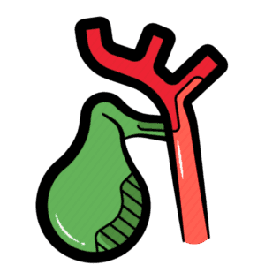 Minimally invasive GallStone surgery procedure in Nashik